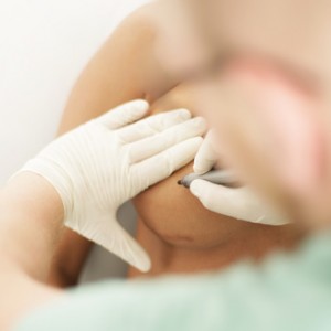 Manhattan Plastic Surgeon on Celebrity's Breast Reduction