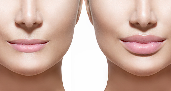 Allure Plastic Surgery Blog | Kim Zolciak-Biermann Shares Her Lip Enhancement with Snapchat