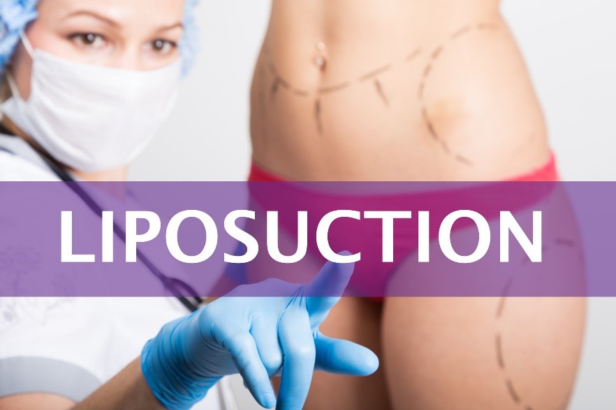 Allure Plastic Surgery Blog | The Ultimate Guide to Liposuction Surgery