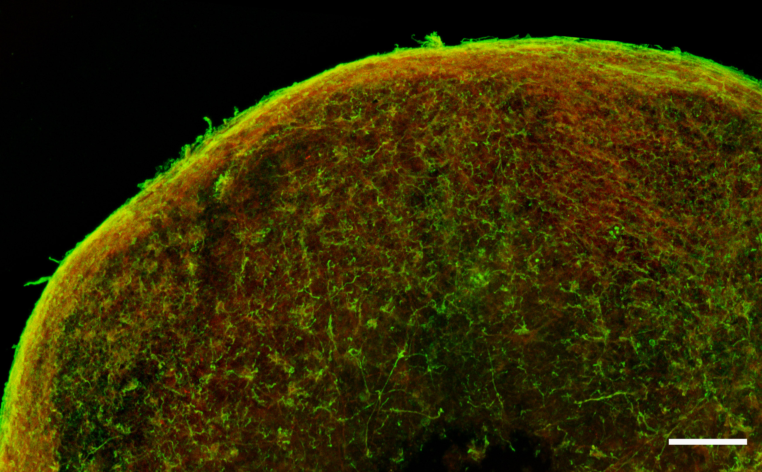 3D-Zellmodelle zur besseren Erforschung von Parkinson