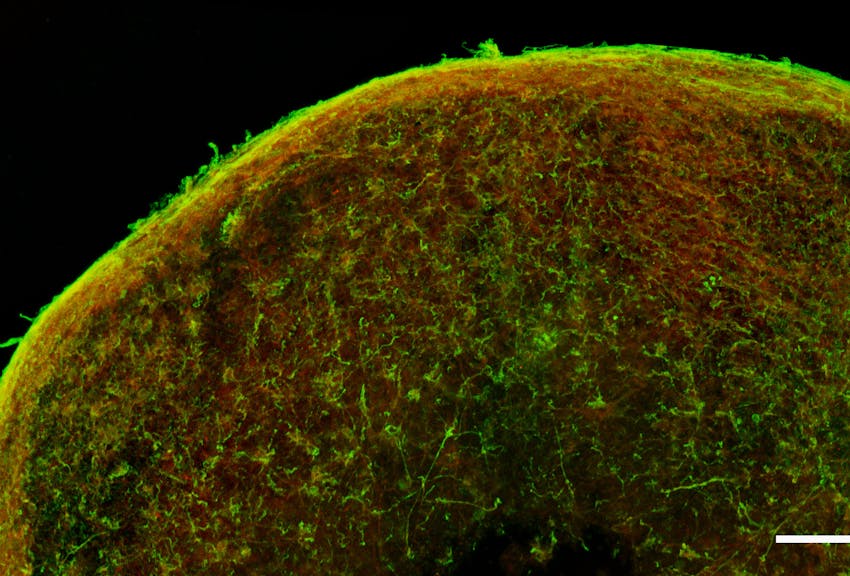 3D-Zellmodelle zur besseren Erforschung von Parkinson