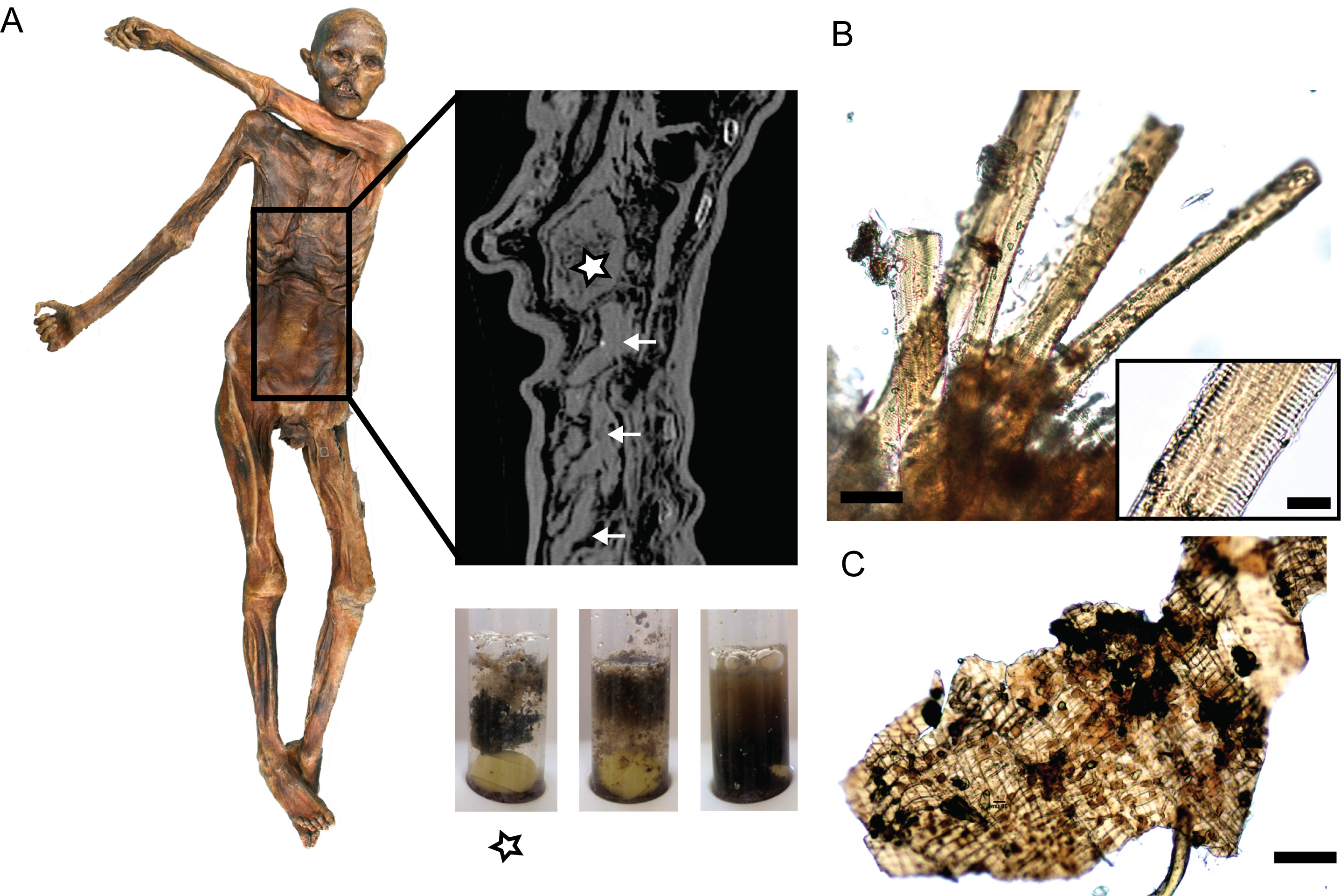 The Iceman’s last meal contained a remarkably high fat content