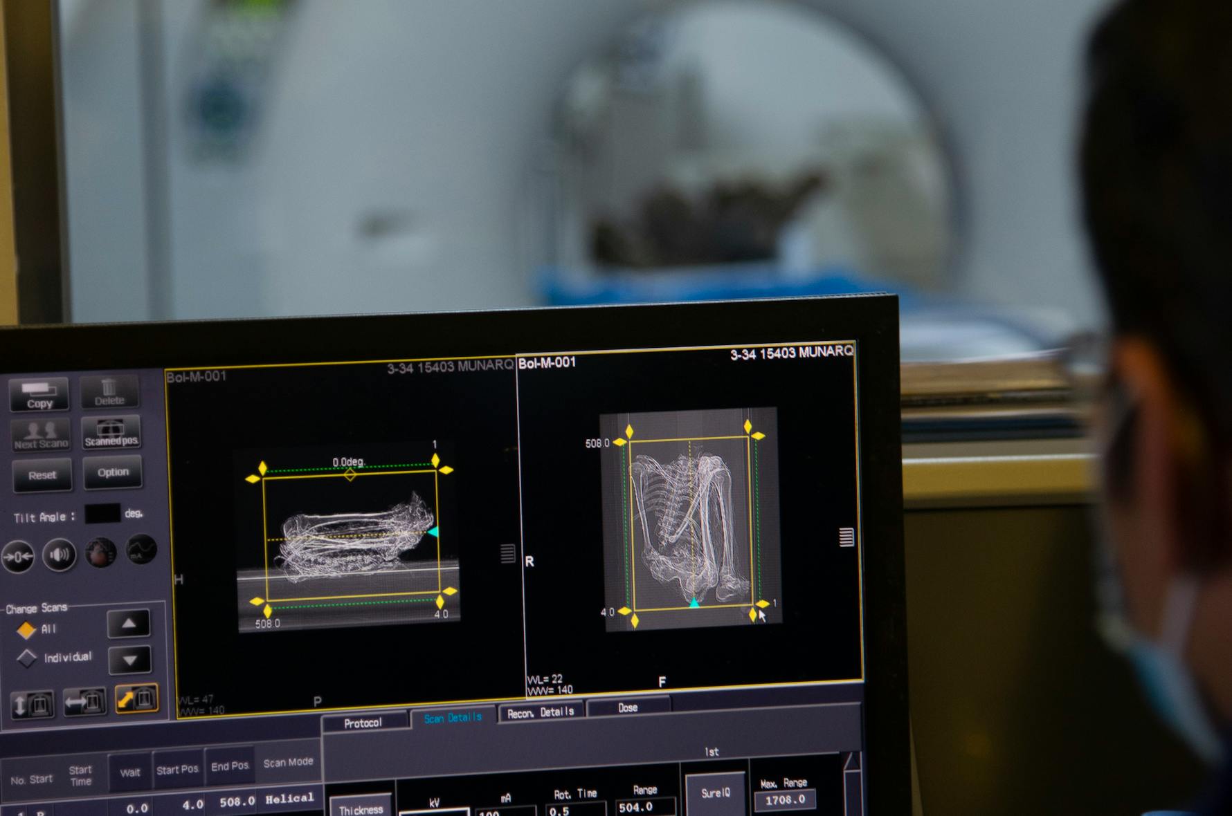 New technology for Bolivia's ancient mummies