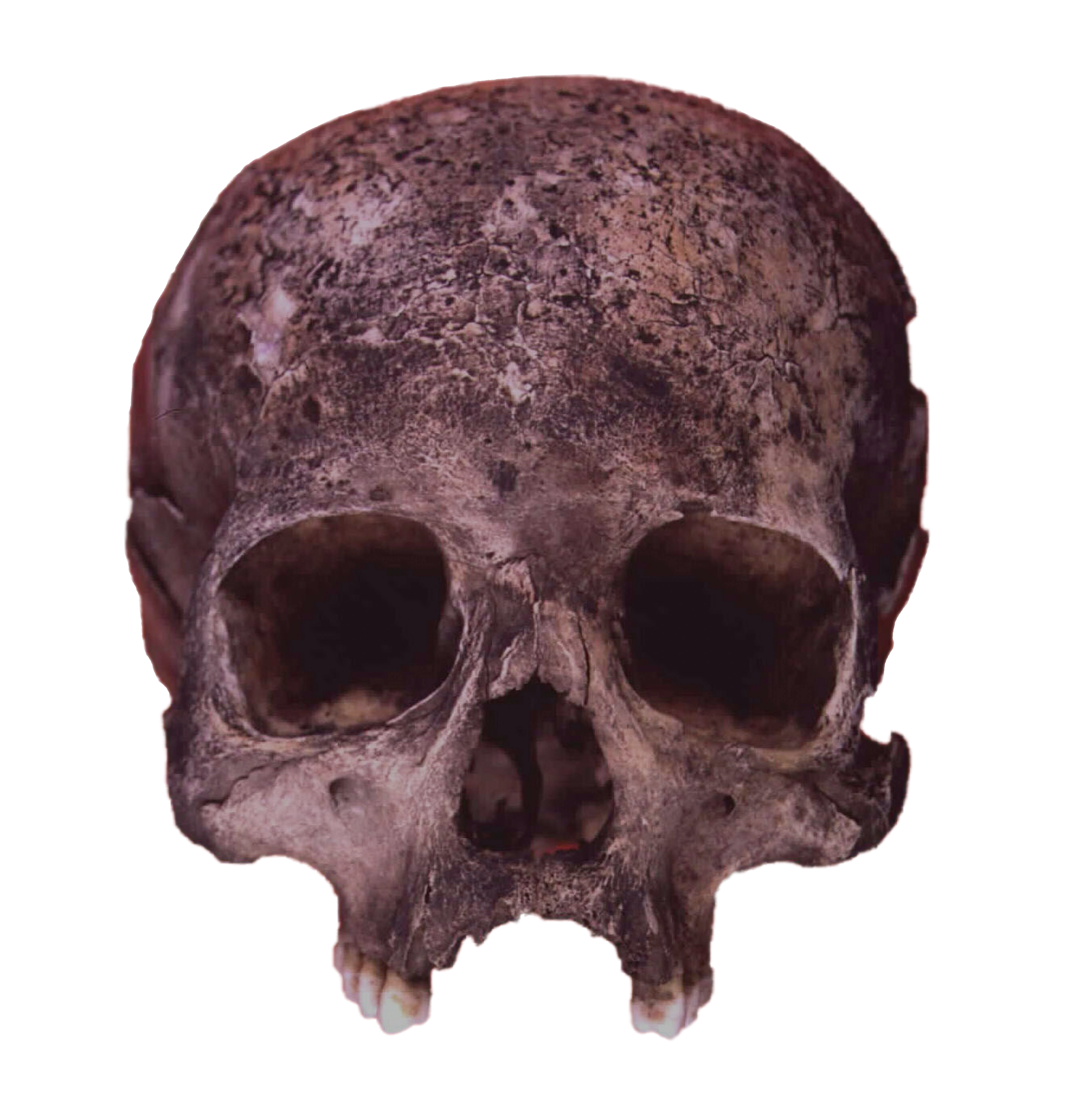Old bones - new knowledge