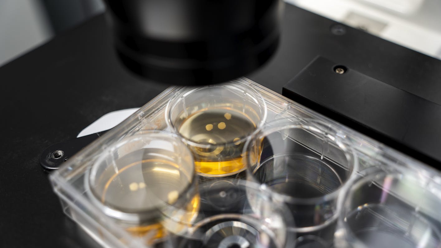 Mit Organoiden die Parkinson-Krankheit erforschen