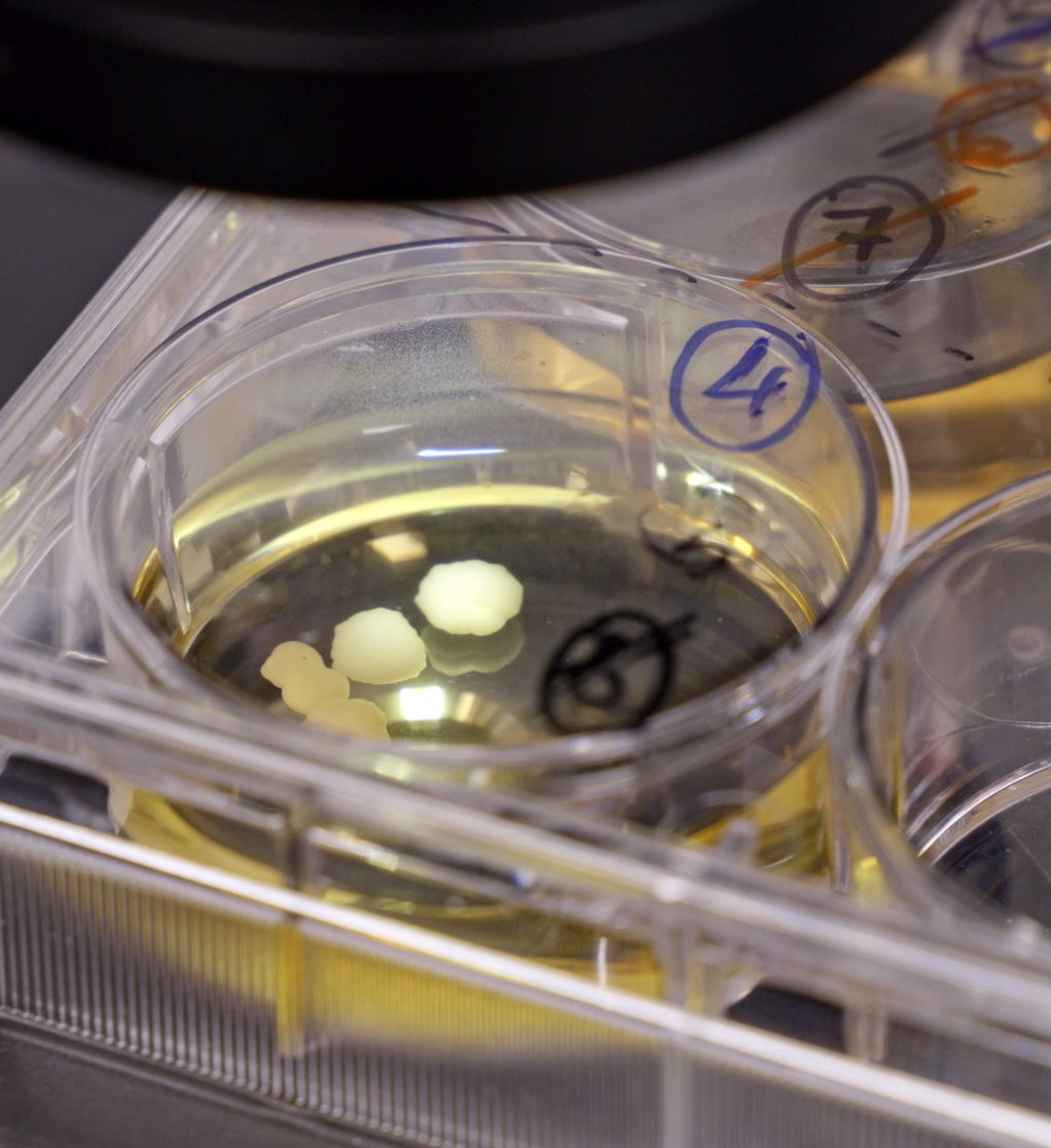 Organoids: Leading the Way in Precision Health