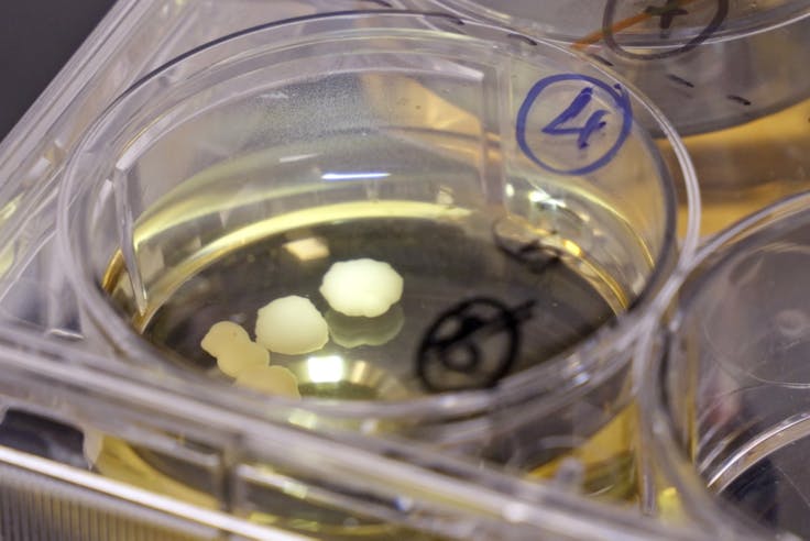 Organoids: Leading the Way in Precision Health