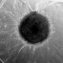 A 17-day-old human midbrain organoid beginning to build new connections sends out nerve fibers.