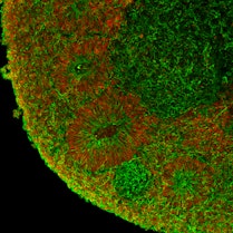 Un organoide del mesencefalo umano di 30 giorni mostra giovani neuroni che si sviluppano e si organizzano in un modello cerebrale in miniatura.
