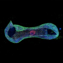 A long strip of green and blue-stained heart tissue, grown from human stem cells, surrounds a small, round pink-stained cluster of nerve cells.