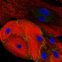 A network of heart muscle cells, with blue-stained nuclei, the connections between the cells colored in green, and the fibers that help the cells contract colored in red.