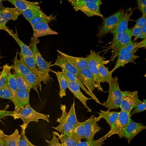 A colorful glimpse inside human neuronal cells reveals their hidden structures.