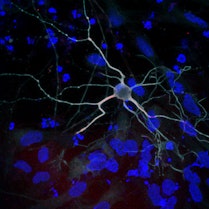 A dopamine-producing neuron grows long extensions that carries signals to other nerve cells.