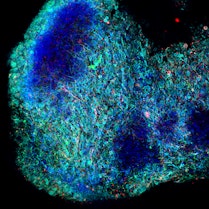 A tiny piece of brain-like tissue grown in the laboratory from human stem cells.