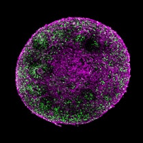 Inside this tiny brain organoid, young dividing cells grow alongside mature neurons that have already formed branching networks.