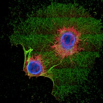 Two clusters of green and red human sympathetic neurons extend long branches and establish connections with other cells.