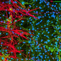 Tiny red-stained nerve fibers reach out to heart muscle cells which have been colored in green. These cells form connections that help control heartbeat. The cell nuclei are shown in blue.