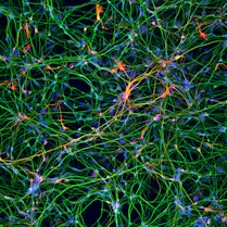 Neuroni che producono dopamina si allungano gli uni verso gli altri, formando una rete di connessioni.
