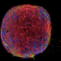 A tiny planet of human neurons with branches reaching out to form a network in 3D.