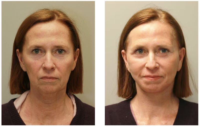 Hessler Plastic Surgery