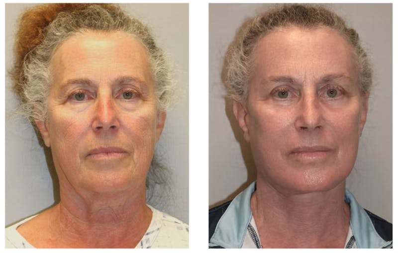 Hessler Plastic Surgery