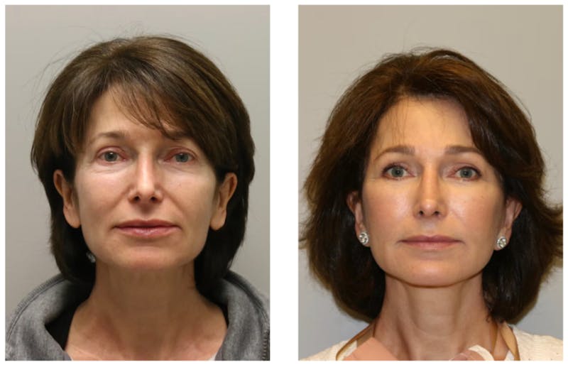 Hessler Plastic Surgery