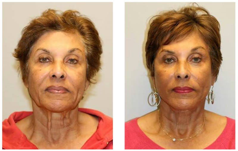 Hessler Plastic Surgery