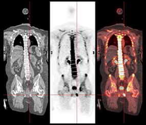 Nuclear Images 