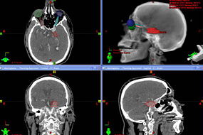 PET/CT Scan images