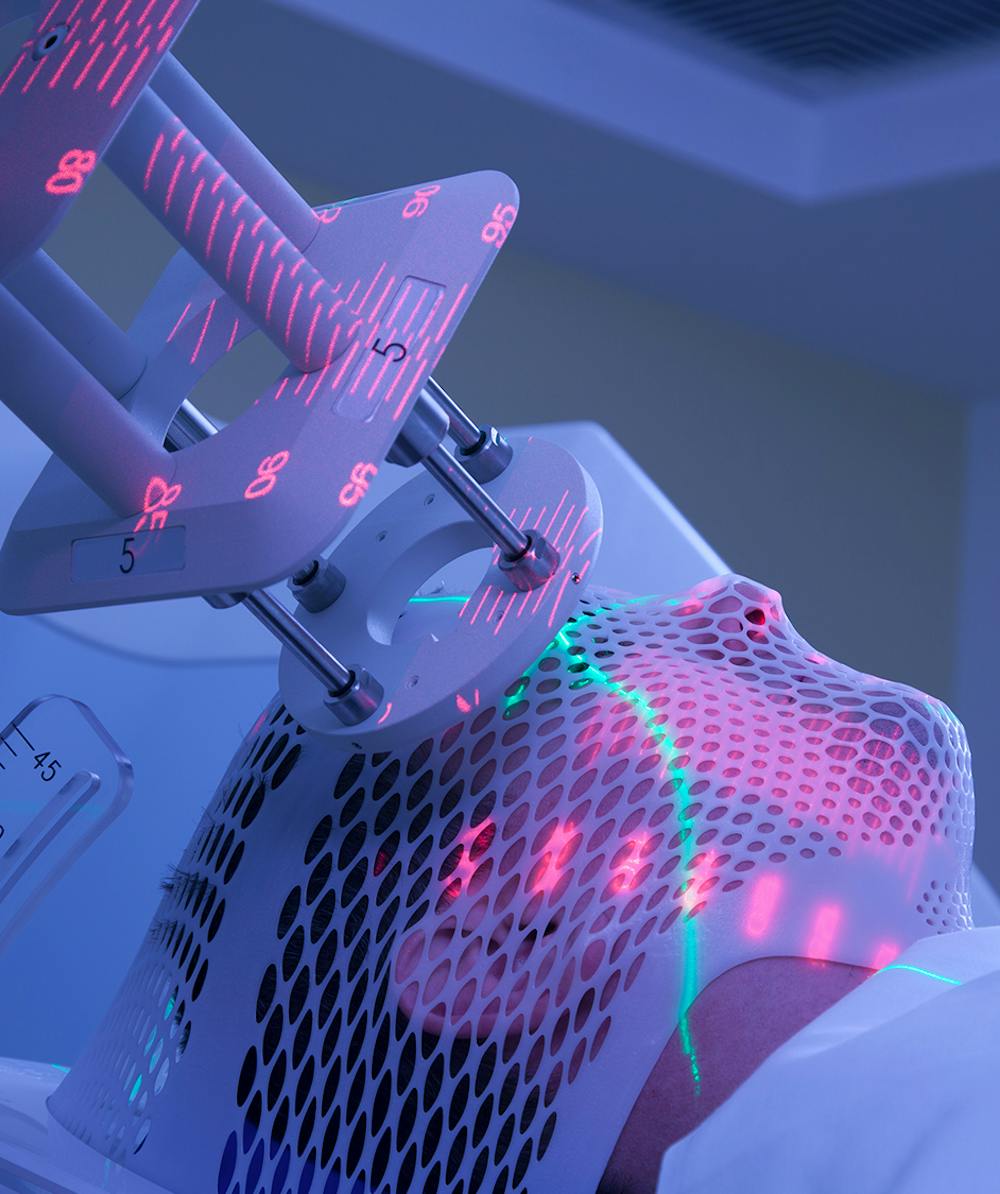 High Dose External Radiation Therapy Los Angeles