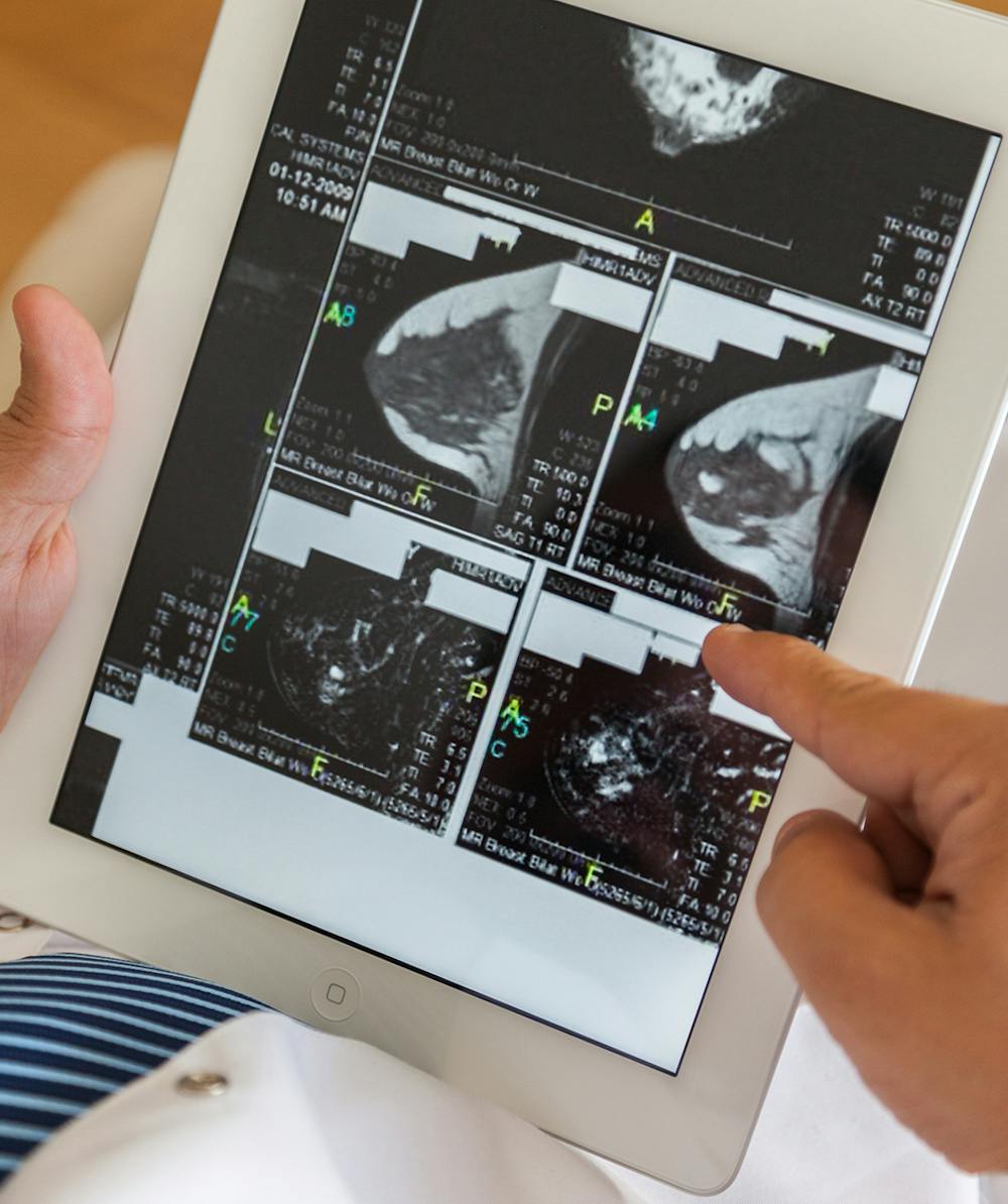 Doctor looking down at mammogram