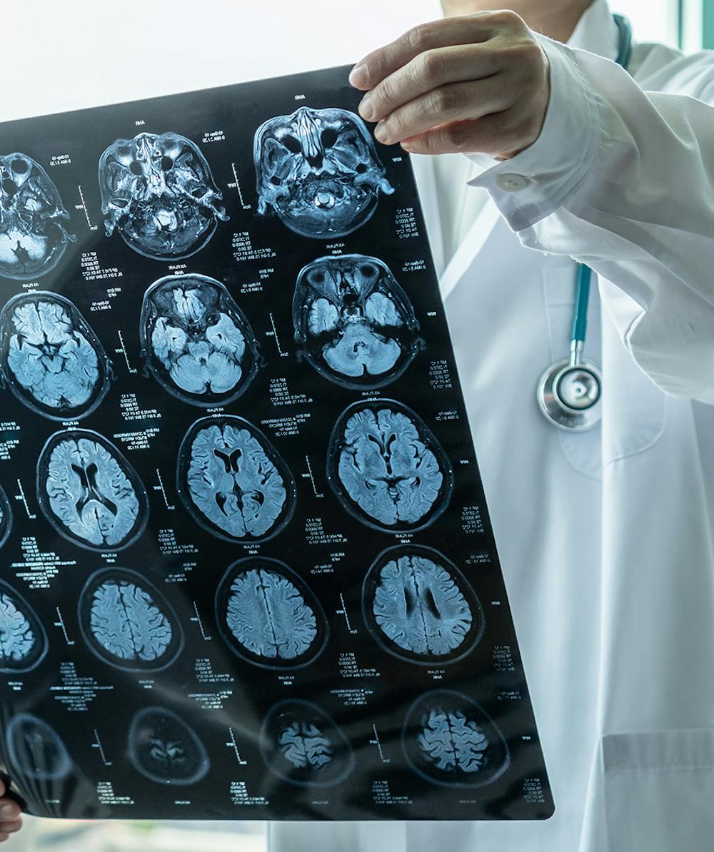 Doctor looking at MRI-scan chart