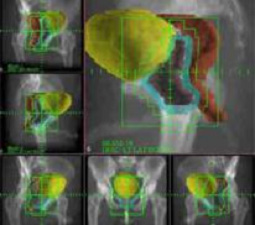 External Radiation 3D computer generated image