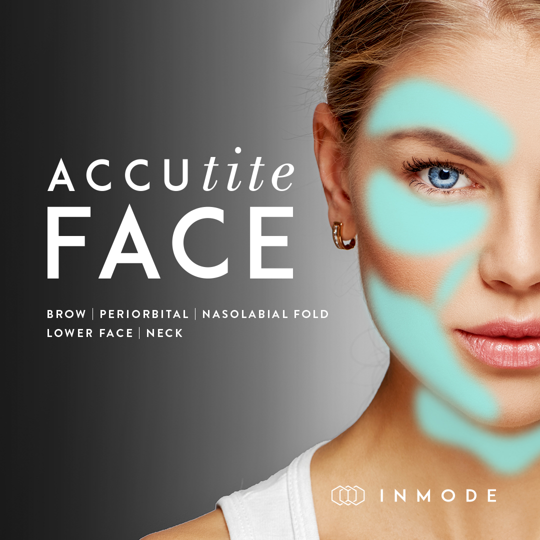 Accutite face advertisement with blue eyed woman