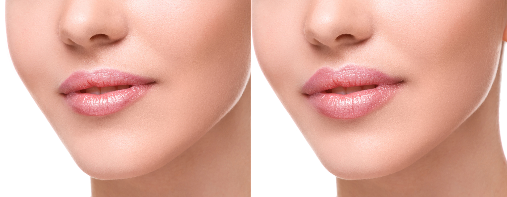Dr. Victoria Givens  Blog | Looking For a More Permanent Option Than Lip Filler?