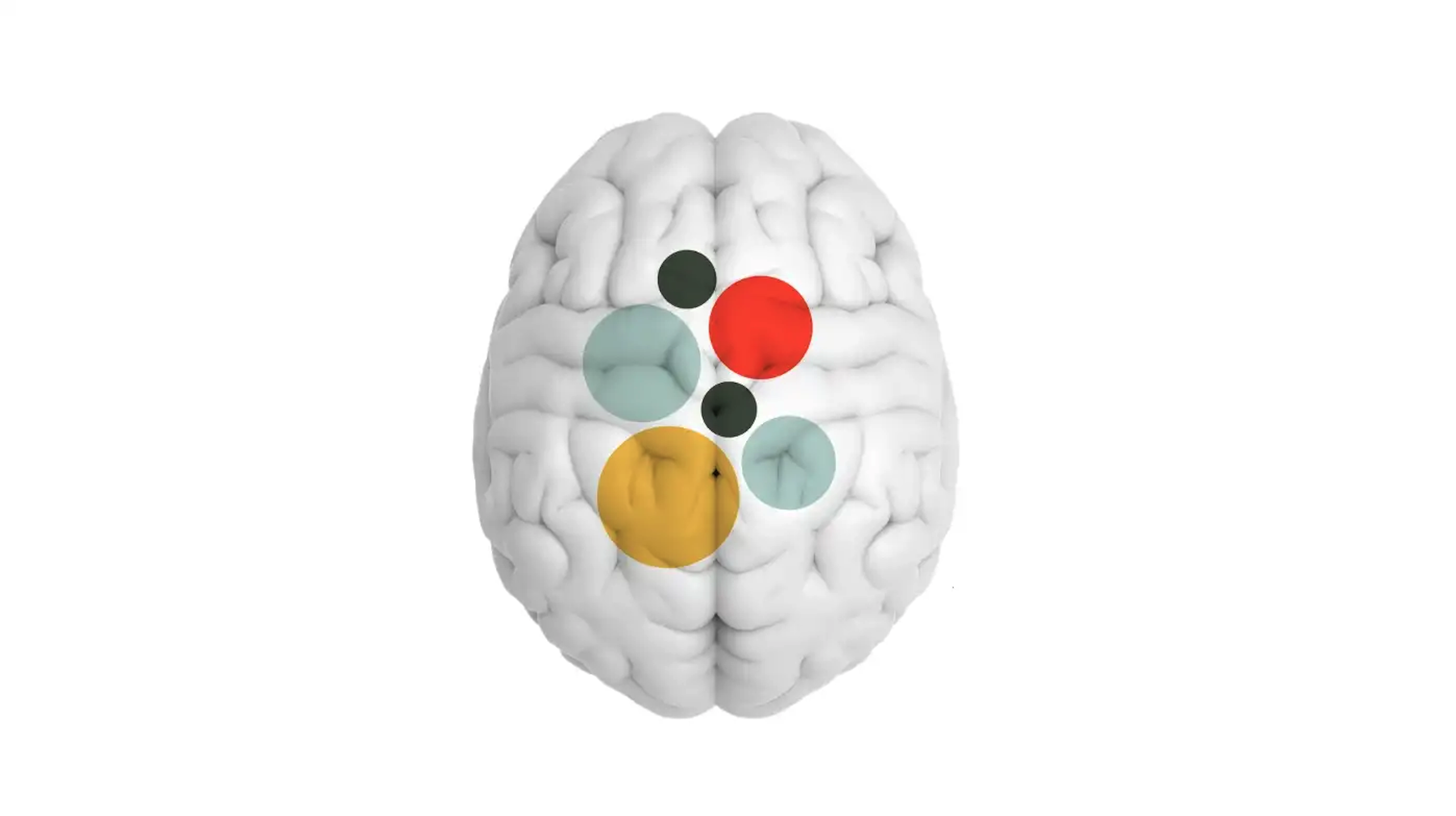 Brain with colored circles