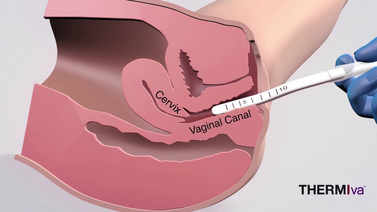 Vaginal Rejuvenation Explained - What it Does & How it Works
