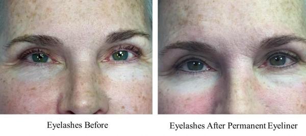 JUVA Skin & Laser Center Blog | The Eyes Say It All