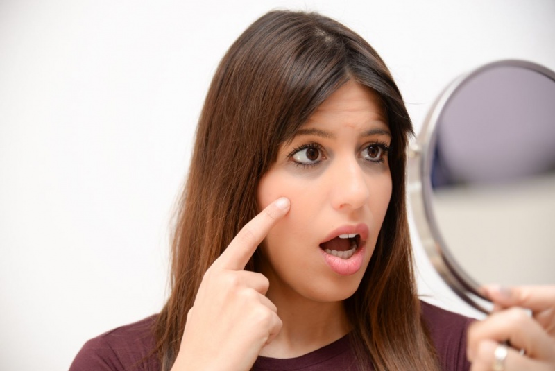 JUVA Skin & Laser Center Blog | Are Dark Circles Making You Look Tired?