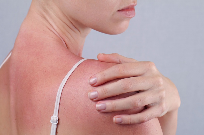 JUVA Skin & Laser Center Blog | Photodynamic Therapy (PDT) for Sun Damaged Skin Is Here!