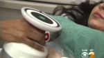 JUVA Skin & Laser Center Blog | UltraShape Ultrasound Treatment for Fat Melting - Dr. Katz - CBS