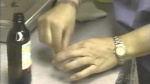 JUVA Skin & Laser Center Blog | Aging Hands - NBC - Dr. Bruce Katz