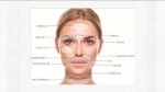 JUVA Skin & Laser Center Blog | The New Way to do Fillers with Nova Threads