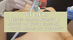 JUVA Skin & Laser Center Blog | CellFX : Treats small bumps or spots on your face