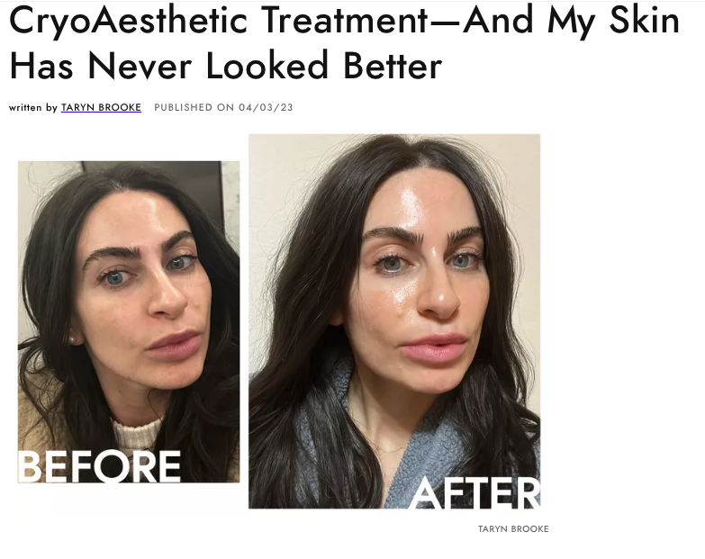 JUVA Skin & Laser Center Blog | Byrdie published an article 