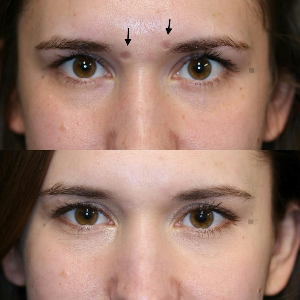 Regenerative Medicine Before & After Gallery - Patient 114700474 - Image 2