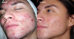 DiamondGlow Before and After