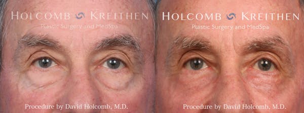 procedure