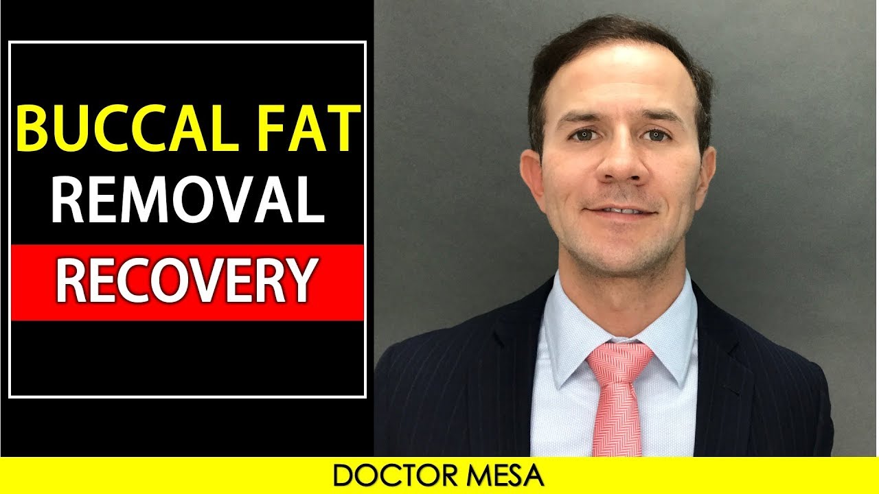 A headshot of the doctor talking about buccal fat removal recovery