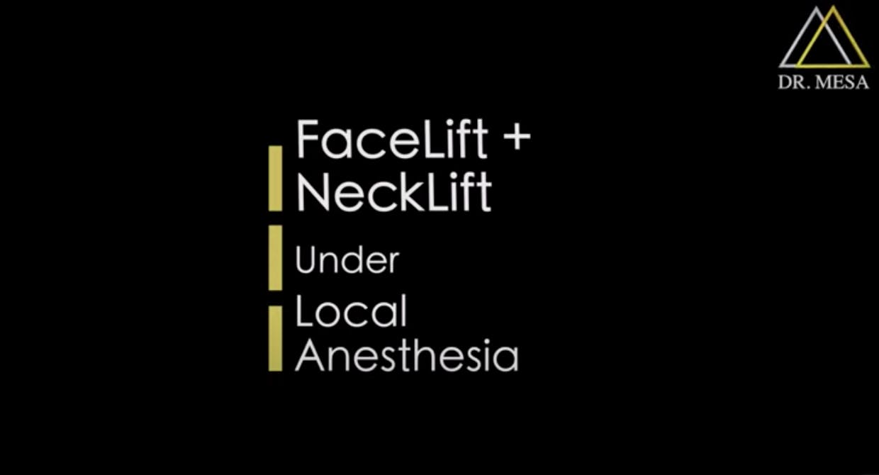 A cover photo of the video about facelift + necklift under local anesthesia